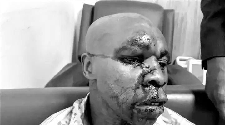 Kinshasa : trois militants de Lamuka blessés dans une nouvelle attaque contre le cortège de Martin Fayulu attribuée à la Force du progrès